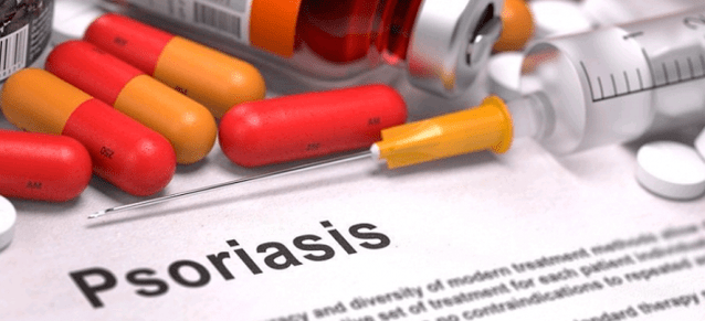 medications for psoriasis