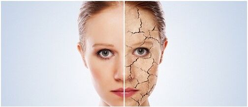 We treat psoriasis